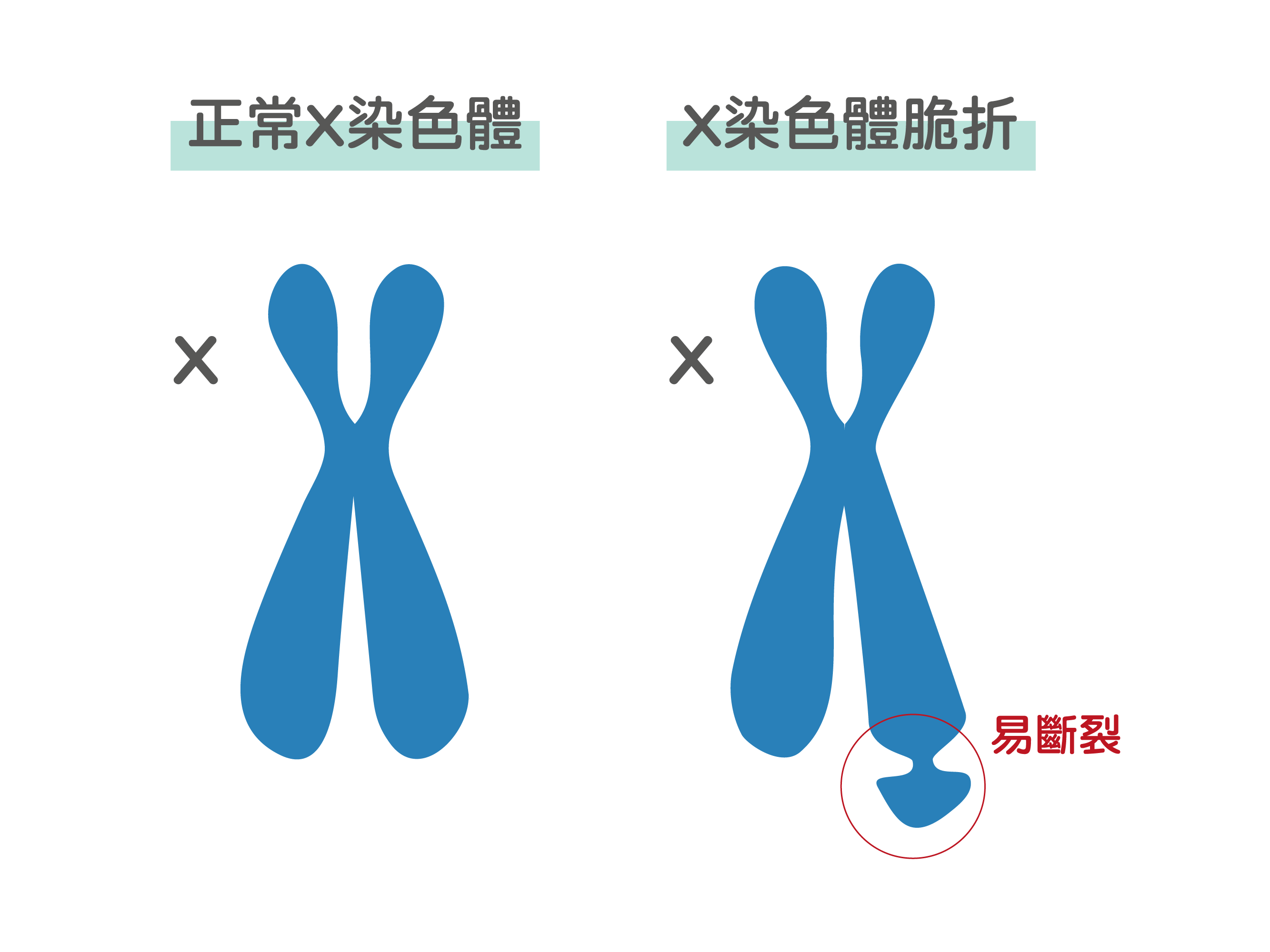 X染色體脆折症 X染色體斷點